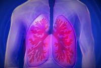 Medizinisches Bild eines menschlichen Oberkörpers mit Darstellung der Lunge